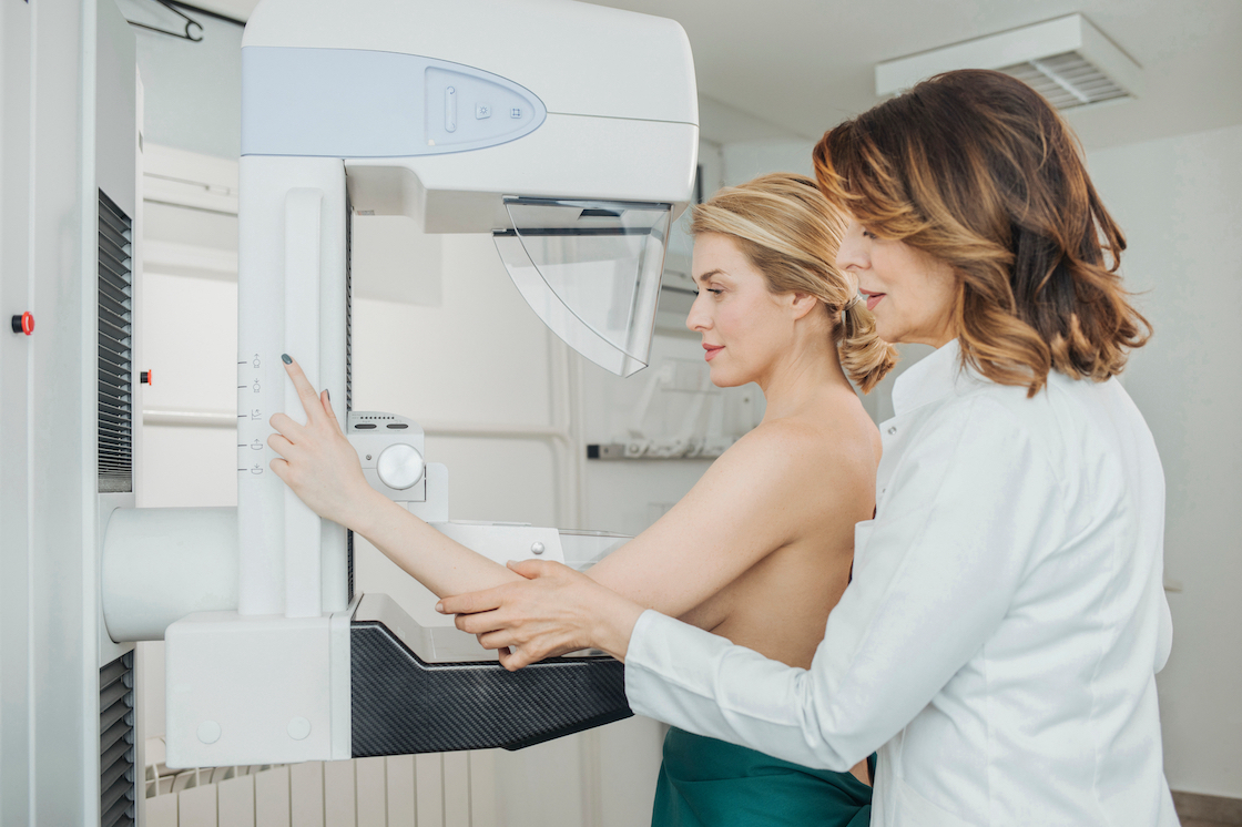 Mammografi screening