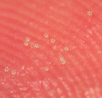 microspheres on a fingertip in reality.